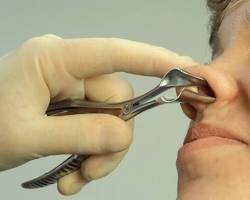 Premium Vienna Nasal Speculum – Stainless Steel - Image 2